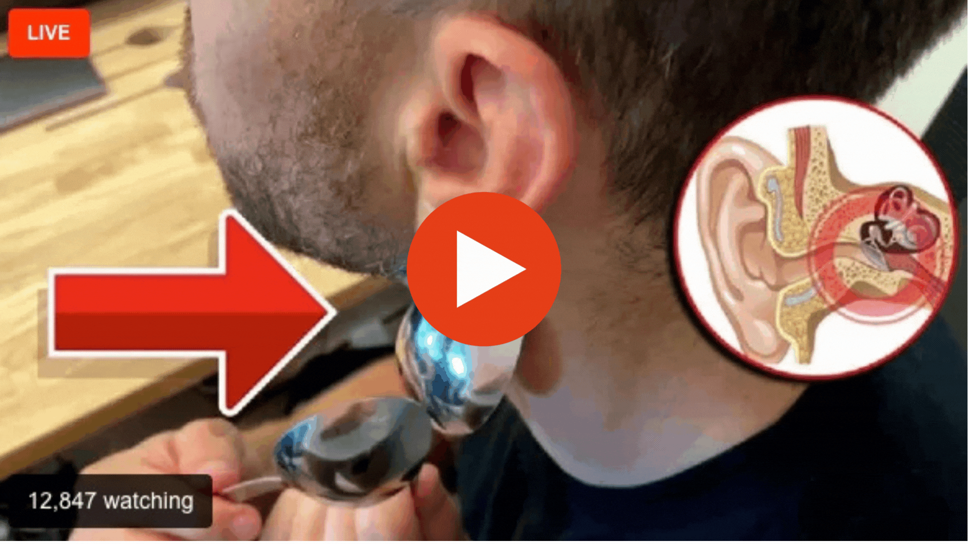 Tinnitus Video Mobile